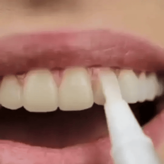 SmileFitPro™ Teeth Whitening Pen
