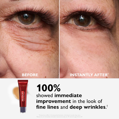 🔥 Last 3 Hours 50% OFF ✨ BUY 1 GET 1 FREE🔥Eye Bag Eraser — Instantly Refreshes, Firms & Smooths for a Youthful Look That Lasts 8 Hours