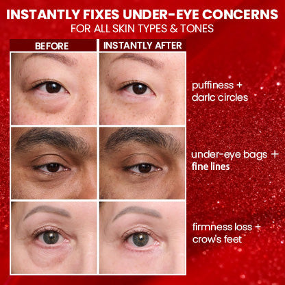 🔥 Last 3 Hours 50% OFF ✨ BUY 1 GET 1 FREE🔥Eye Bag Eraser — Instantly Refreshes, Firms & Smooths for a Youthful Look That Lasts 8 Hours